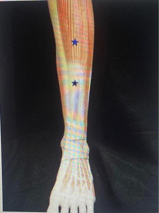 Identify The Muscle Of This Muscle Action 1 Action 2 A List The 2 Actions A Of The Ankle A Of The Subtalar Joint 1