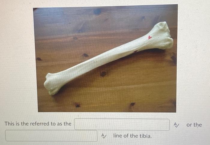 This Is The Referred To As The A Line Of The Tibia A Or The 1