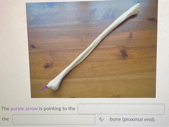 The Purple Arrow Is Pointing To The The A Bone Proximal End 1