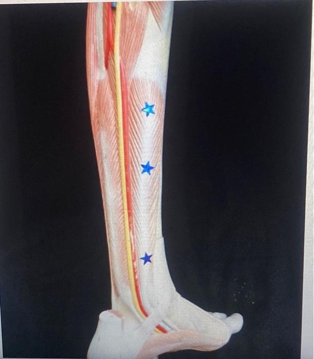 Identify The Muscle Actions Of This Muscle Action 1 Digits 2 5 Action 2 Action 3 A List The Three A Of Of The 1