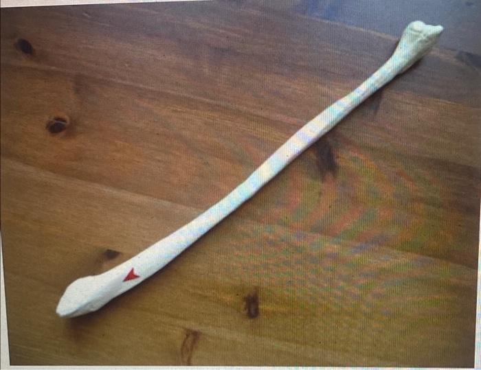 This Is The Here A 2 Words 2 Tendons Sit 2