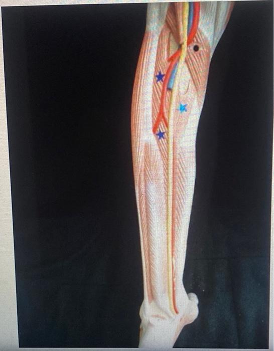 3 Identify The Muscle Of This Muscle Action 1 Action 2 A A List The 2 Actions A Of The Ankle Of The Subtalar Join 1