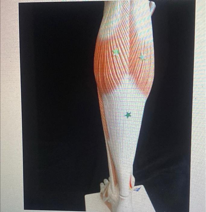 A List The Two Identify The Muscle Actions Of This Muscle Joint Action E G Knee Flexion Action 1 A Action 2 1