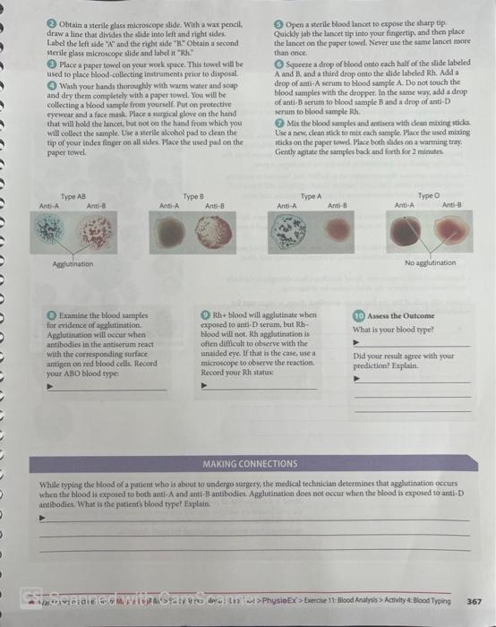 Obtain A Sterile Glass Microscope Slide With A Wax Pencil Draw A Line That Divides The Slide Into Left And Right Sid 1