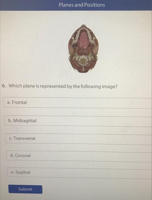 A Frontal 6 Which Plane Is Represented By The Following Image B Midsagittal C Transverse D Coronal E Sagittal Pla 2