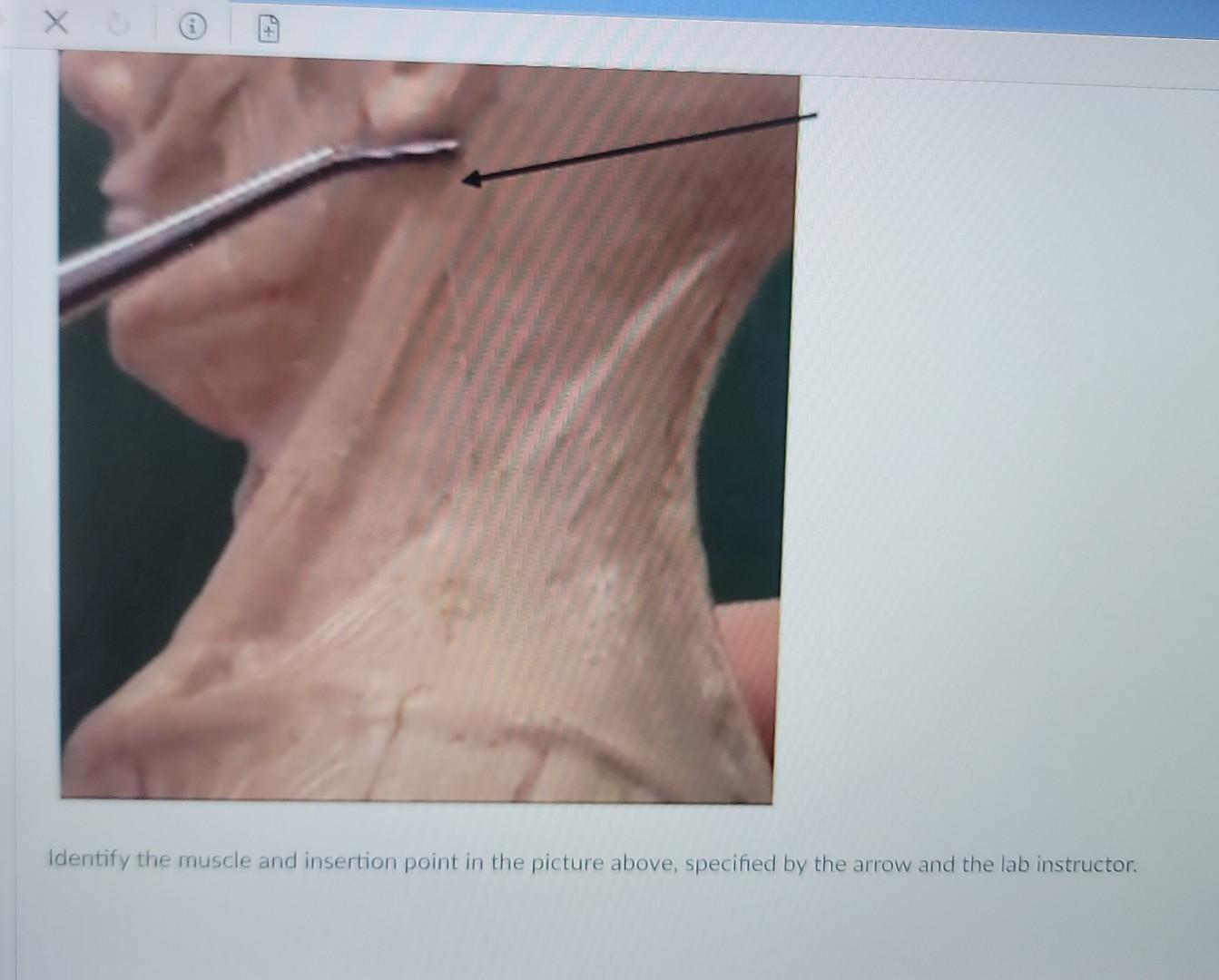 Identify The Muscle And Insertion Point In The Picture Above Specified By The Arrow And The Lab Instructor 1