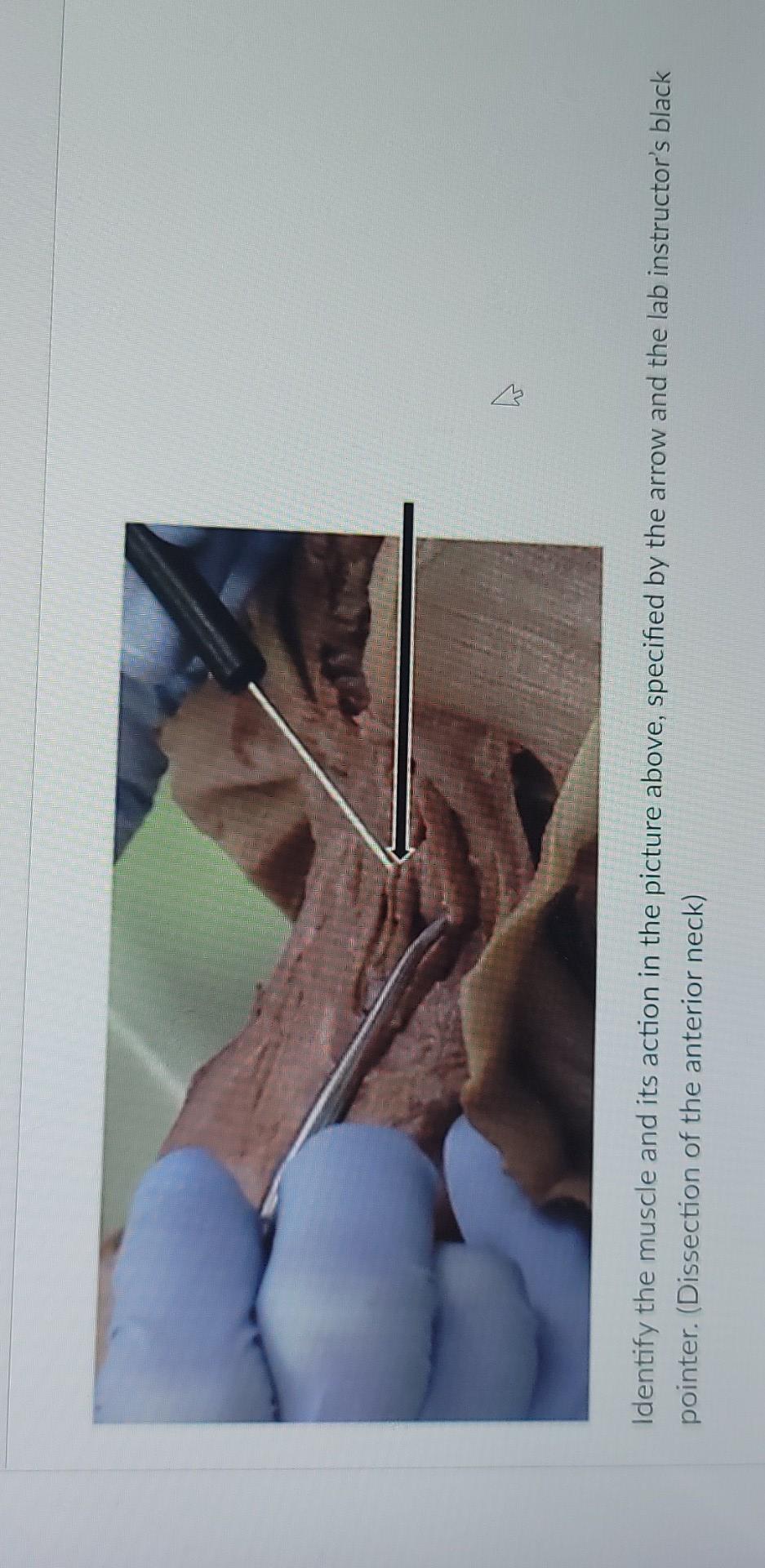 4 Identify The Muscle And Its Action In The Picture Above Specified By The Arrow And The Lab Instructor S Black Pointer 1