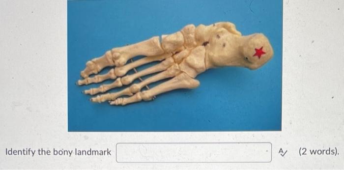 Identify The Bony Landmark A 2 Words The Group Of Starred Ligaments Are Collectively Called The Ligaments A 2 Opti 1