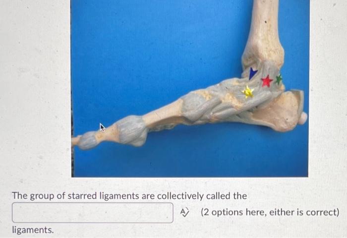 Identify The Bony Landmark A 2 Words The Group Of Starred Ligaments Are Collectively Called The Ligaments A 2 Opti 2