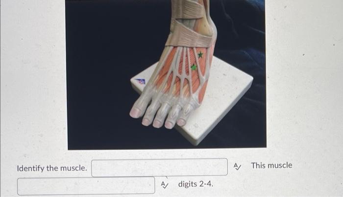This Is The A Ligament Identify The Muscle A Digits 2 4 A This Muscle 2
