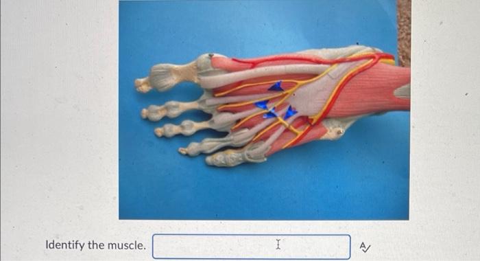 Identify The Muscle This Muscle A List The Action Of Of The Fifth Digit Identify The Muscle A 2