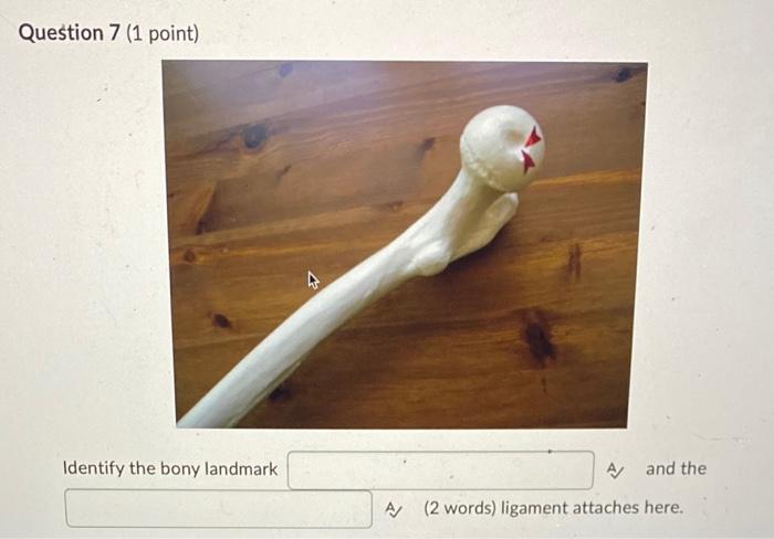 Question 7 1 Point Identify The Bony Landmark A And The A 2 Words Ligament Attaches Here 1