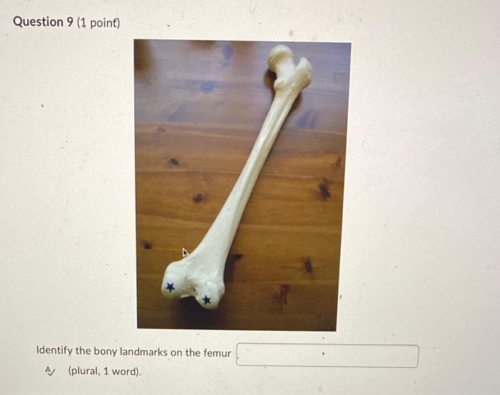 Question 9 1 Point Identify The Bony Landmarks On The Femur A Plural 1 Word 1