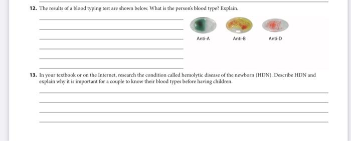 12 The Results Of A Blood Typing Test Are Shown Below What Is The Person S Blood Type Explain Anti A Anti B Anti D 1 1