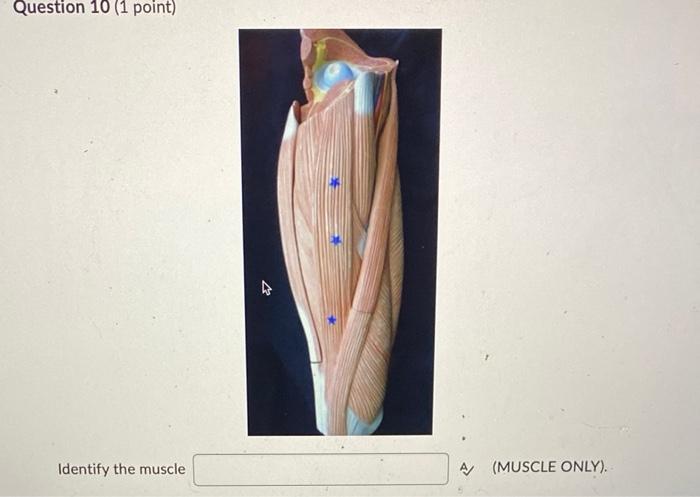 Question 10 1 Point Identify The Muscle A Muscle Only 1