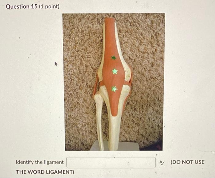 Question 15 1 Point Identify The Ligament The Word Ligament A Do Not Use 1