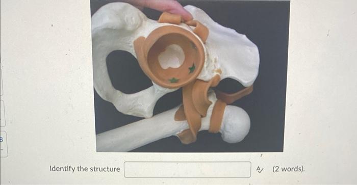 Identify The Structure A 2 Words 1