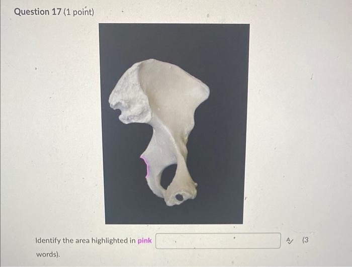 Question 17 1 Point Identify The Area Highlighted In Pink Words A 3 1