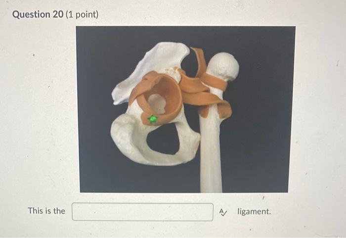 Question 20 1 Point This Is The A Ligament 1