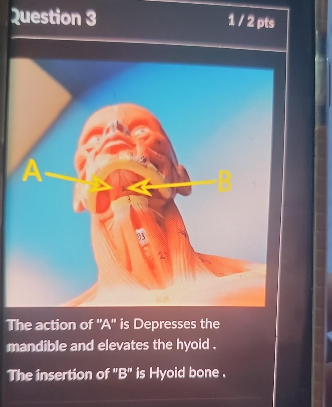 Question 3 A 33 The Action Of A Is Depresses The Mandible And Elevates The Hyoid The Insertion Of B Is Hyoid Bone 1