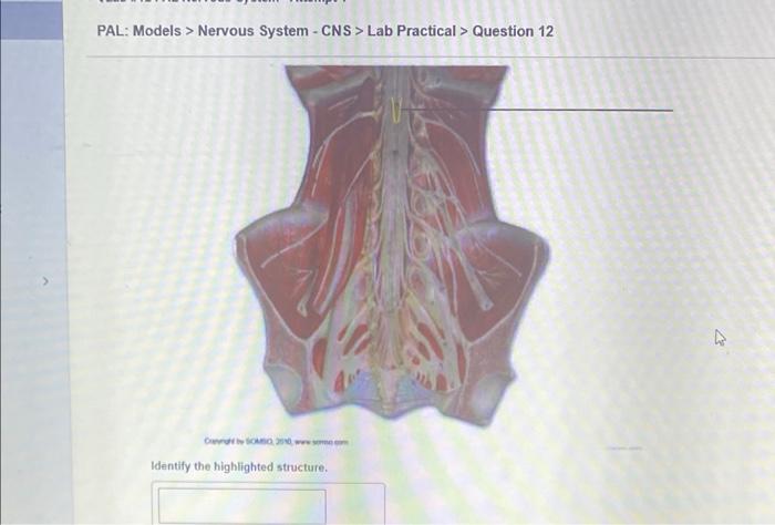 Pal Models Nervous System Cns Lab Practical Question 12 O Sombo 2010 Identify The Highlighted Structure Some C 2