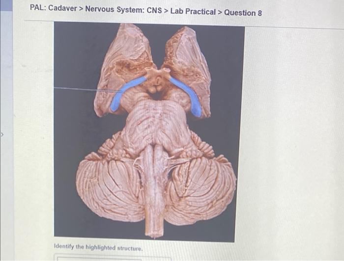 Pal Models Nervous System Cns Lab Practical Question 12 O Sombo 2010 Identify The Highlighted Structure Some C 3