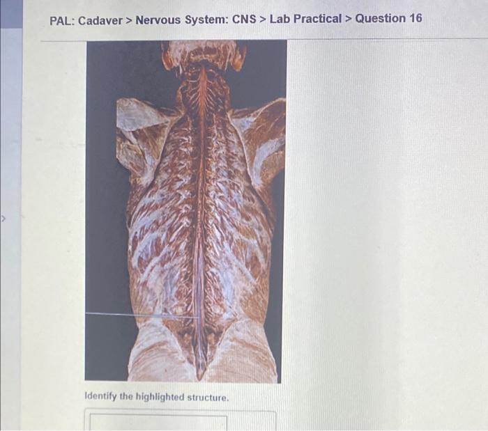 Pal Models Nervous System Cns Lab Practical Question 12 O Sombo 2010 Identify The Highlighted Structure Some C 4