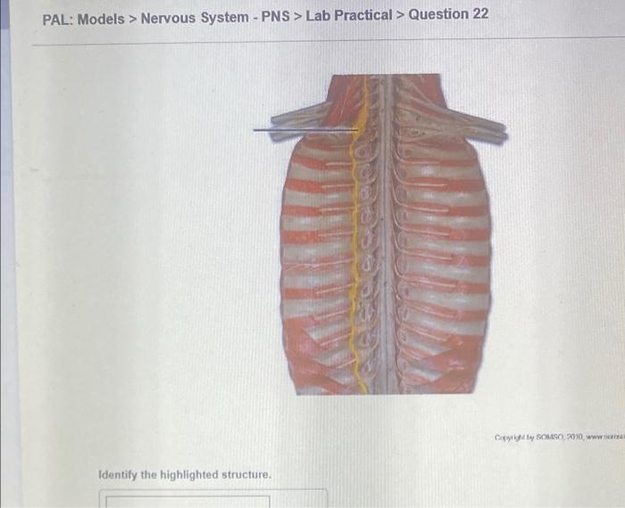Pal Models Nervous System Cns Lab Practical Question 12 O Sombo 2010 Identify The Highlighted Structure Some C 5