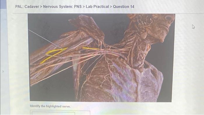 Pal Models Nervous System Cns Lab Practical Question 12 O Sombo 2010 Identify The Highlighted Structure Some C 7