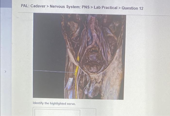 Pal Models Nervous System Cns Lab Practical Question 12 O Sombo 2010 Identify The Highlighted Structure Some C 8