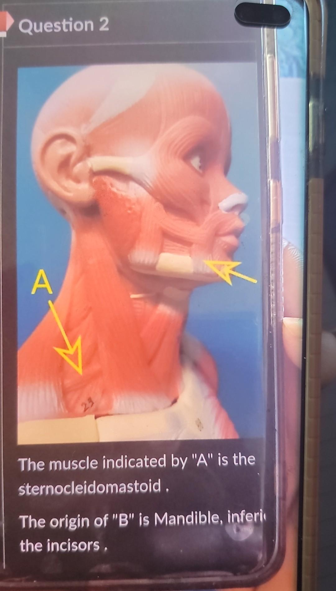 Question 2 A 29 The Muscle Indicated By A Is The Sternocleidomastoid The Origin Of B Is Mandible Inferi The Inciso 1