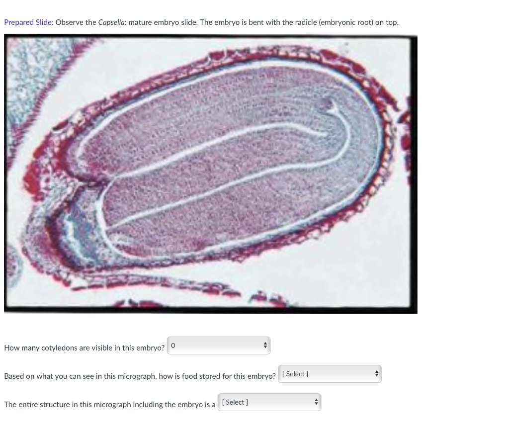 Prepared Slide Observe The Capsella Mature Embryo Slide The Embryo Is Bent With The Radicle Embryonic Root On Top 1