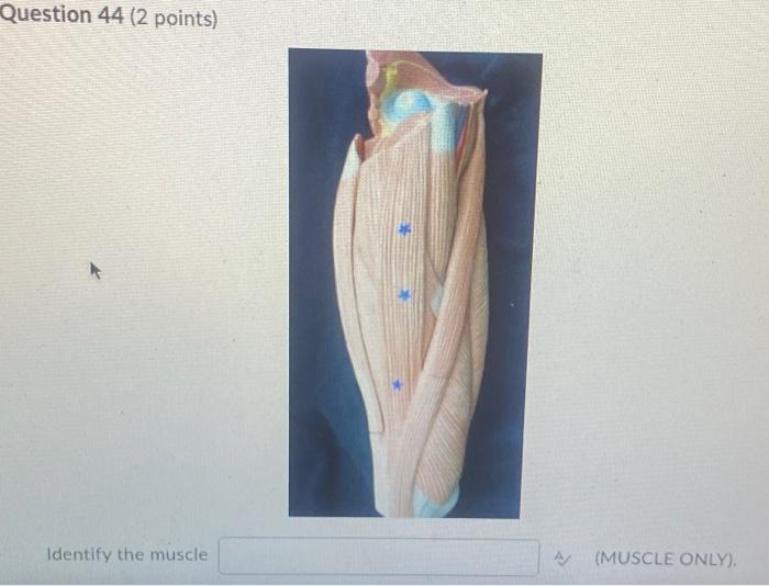 Kinesiology Please Help Answer Fast 1