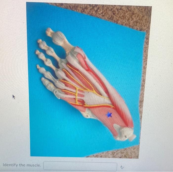 Identify The Muscle 1