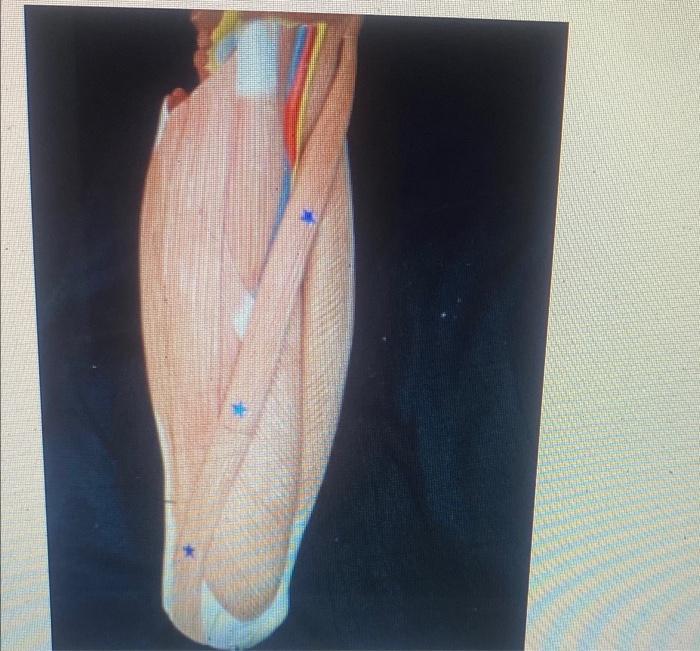 Kinesiology Please Help Answer Fast 2