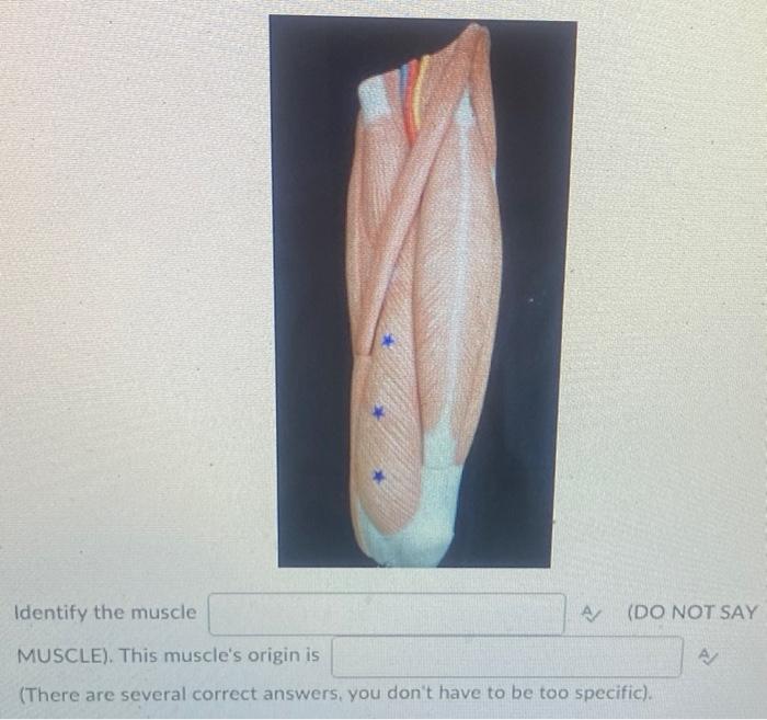 Kinesiology Please Help Answer Fast 1