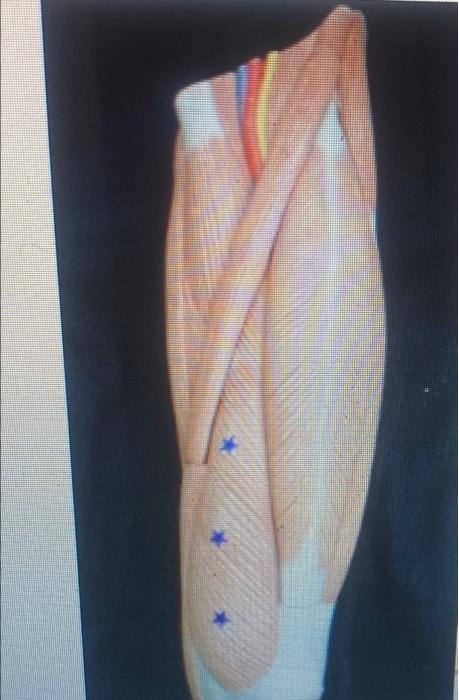 Kinesiology Please Help Answer Fast 2