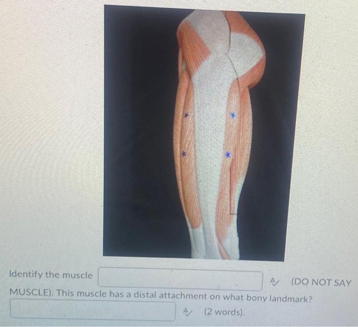 Identify The Muscle Muscle This Muscle Has A Distal Attachment On What Bony Landmark A 2 Words A Do Not Say 2