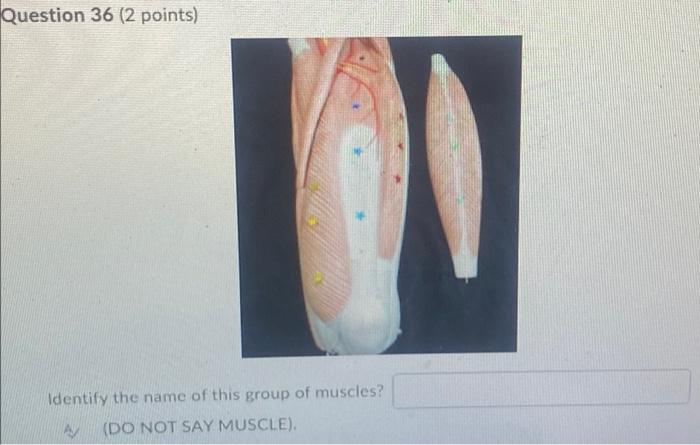 Kinesiology Please Help Answer Fast 1