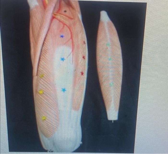 Kinesiology Please Help Answer Fast 2