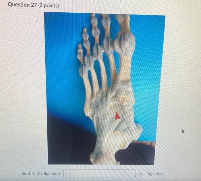 Kinesiology Please Help Answer Fast 1