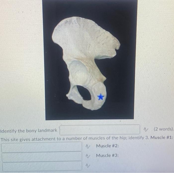 Kinesiology Please Help Answer Fast 1