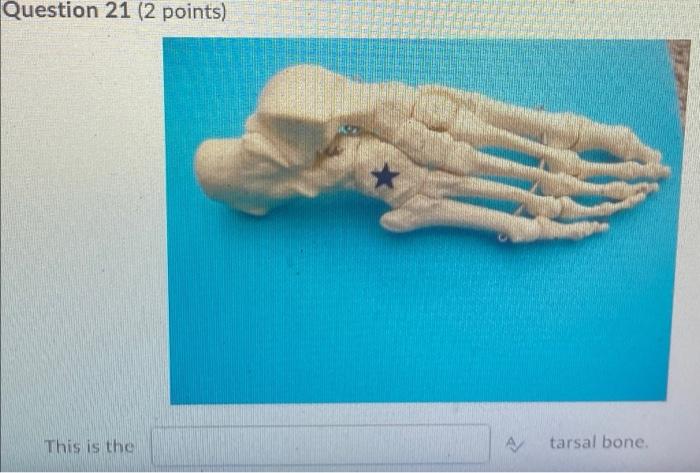 Kinesiology Please Help Answer Fast 1