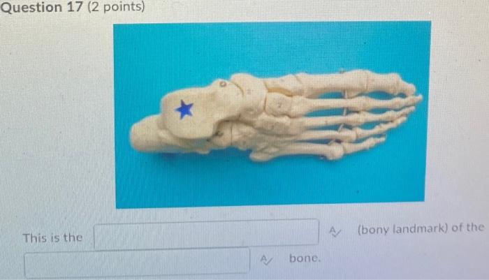 Kinesiology Please Help Answer Fast 1