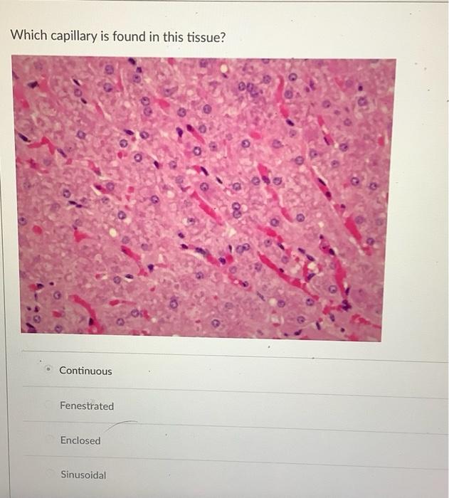 Which Capillary Is Found In This Tissue Continuous Fenestrated Enclosed Sinusoidal Which Cell Type Is In The Blood Ves 1