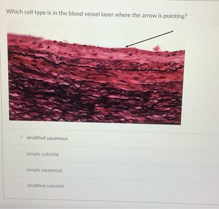 Which Capillary Is Found In This Tissue Continuous Fenestrated Enclosed Sinusoidal Which Cell Type Is In The Blood Ves 2