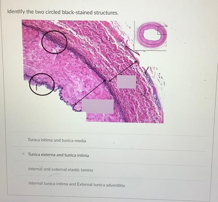 Which Capillary Is Found In This Tissue Continuous Fenestrated Enclosed Sinusoidal Which Cell Type Is In The Blood Ves 3