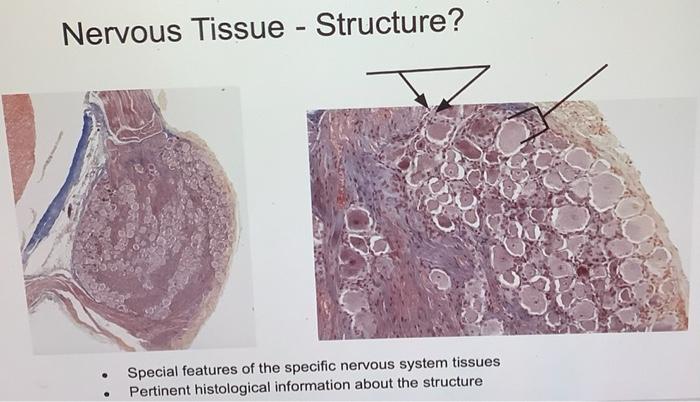 Nervous Tissue Structure Special Features Of The Specific Nervous System Tissues Pertinent Histological Information A 1