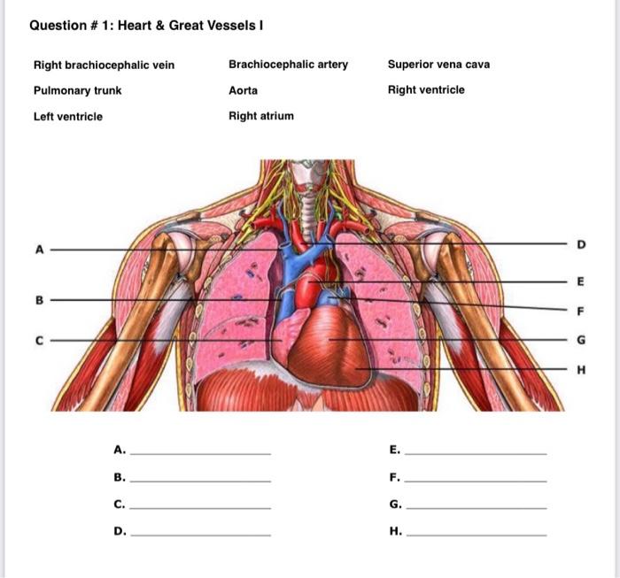 Question 1 Heart Great Vessels I Right Brachiocephalic Vein Pulmonary Trunk Left Ventricle B C A B C D Brachioc 1