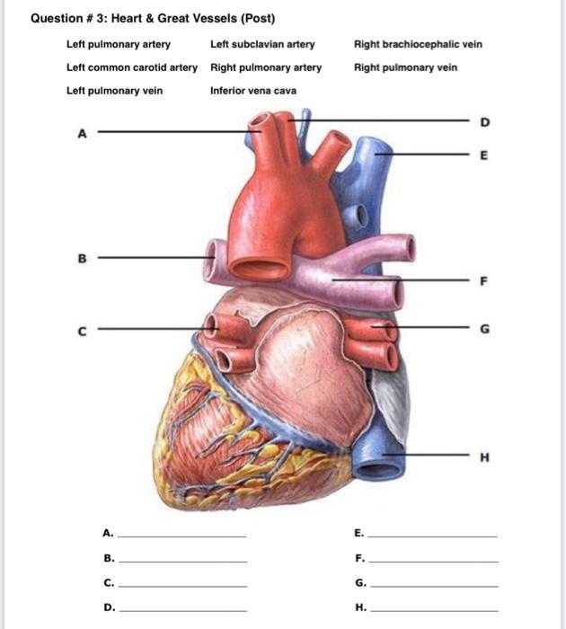 Question 3 Heart Great Vessels Post Left Pulmonary Artery Left Common Carotid Artery Left Pulmonary Vein B A B 1